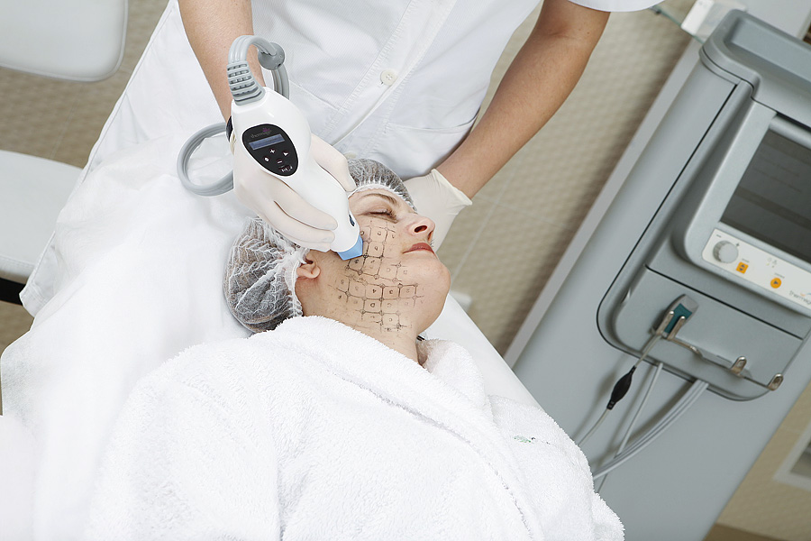 ���������, ������������� ����.